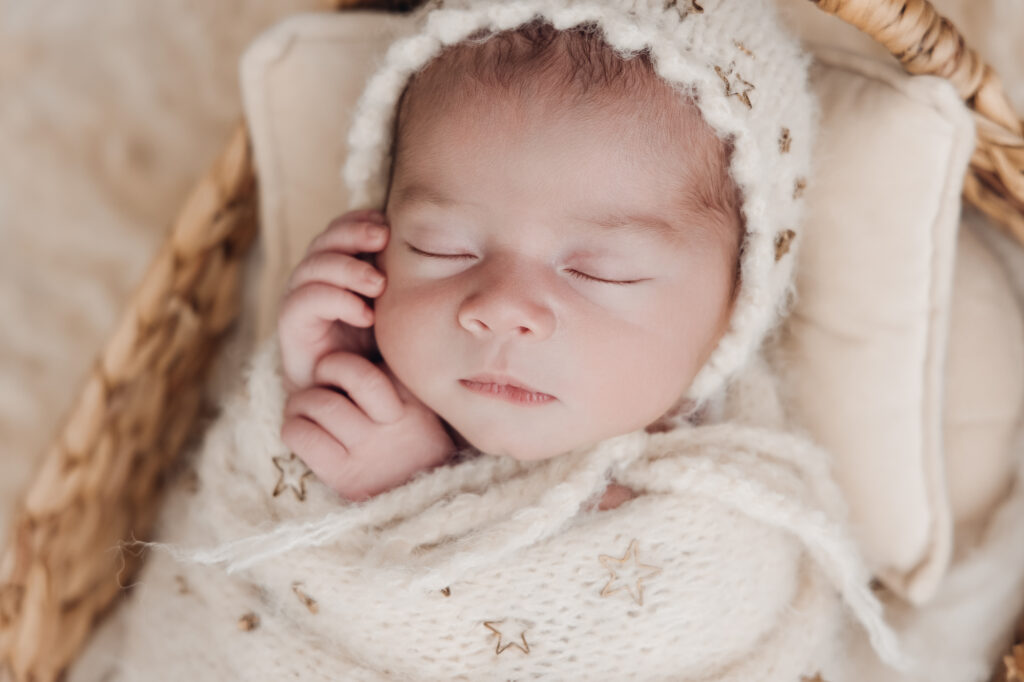 Séance photo bébé avec coliques ou acné : est-ce possible ?